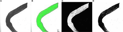 Methodological precision of in situ and in vitro algal density measurements in the model cnidarian, Exaiptasia diaphana